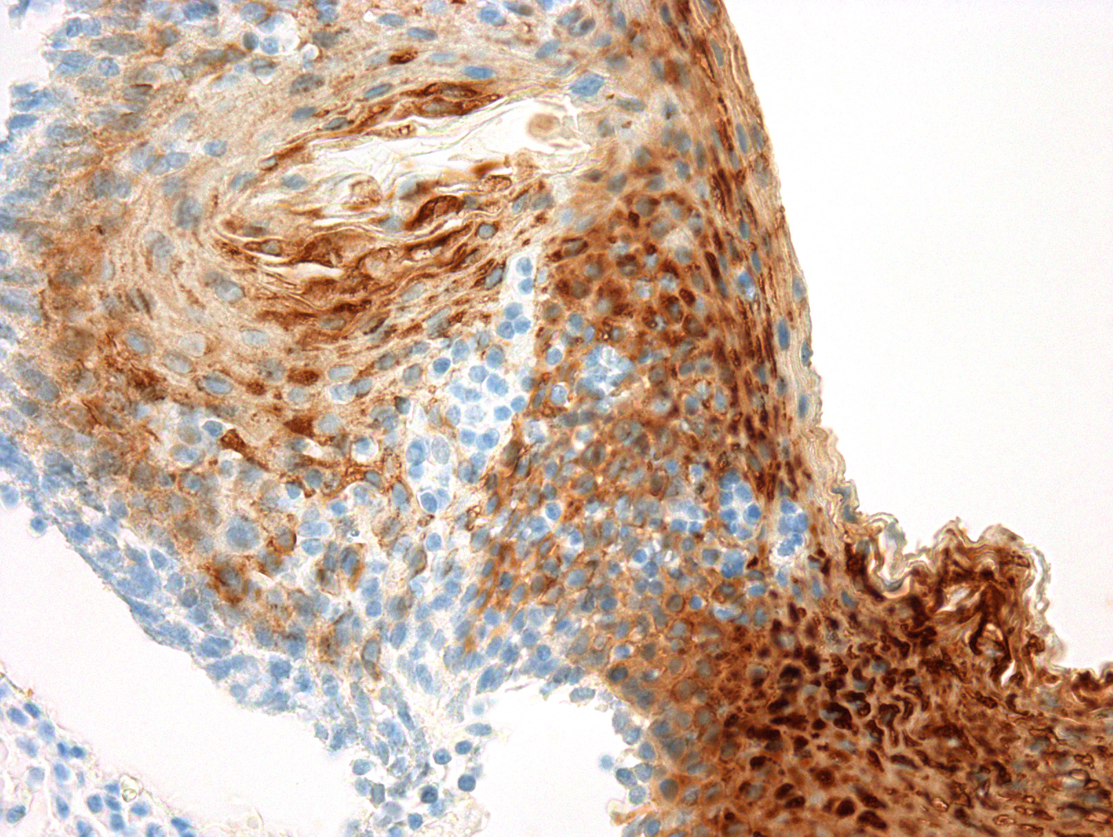 Cytokeratin 13 antibody [KS-1A3]
