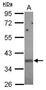 KIR2DS2 antibody