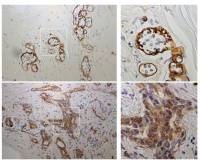 Laminin gamma 2 antibody [P2H]