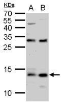 S100A9 antibody