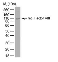 Factor VIII antibody [RFF-VIIIC/10]