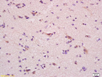 ganglioside GM1 antibody
