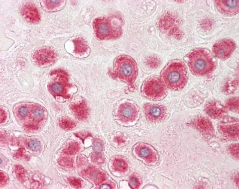 RPLP1 antibody [N1C3]