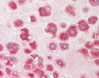 RPLP1 antibody [N1C3]