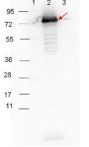 Surface Lipoprotein P27 antibody