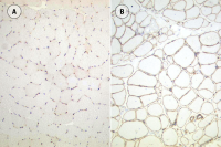 Utrophin antibody [DRP3/20C5]