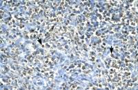 ASGR2 antibody, N-term