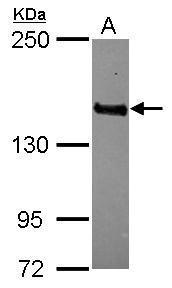 MAGI3 antibody [N1N2], N-term