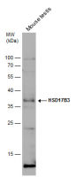 HSD17B3 antibody