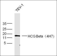hCG beta antibody [4H7]