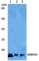 SNRPD3 antibody