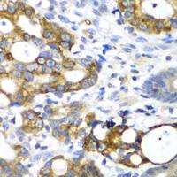 alpha amylase 2A (pancreatic) antibody