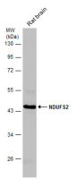 NDUFS2 antibody