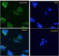 alpha Smooth Muscle Actin antibody, N-term