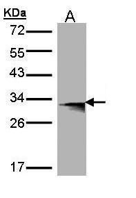 HLA-DMB antibody [C2C3], C-term