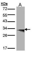 HLA-DMB antibody [C2C3], C-term
