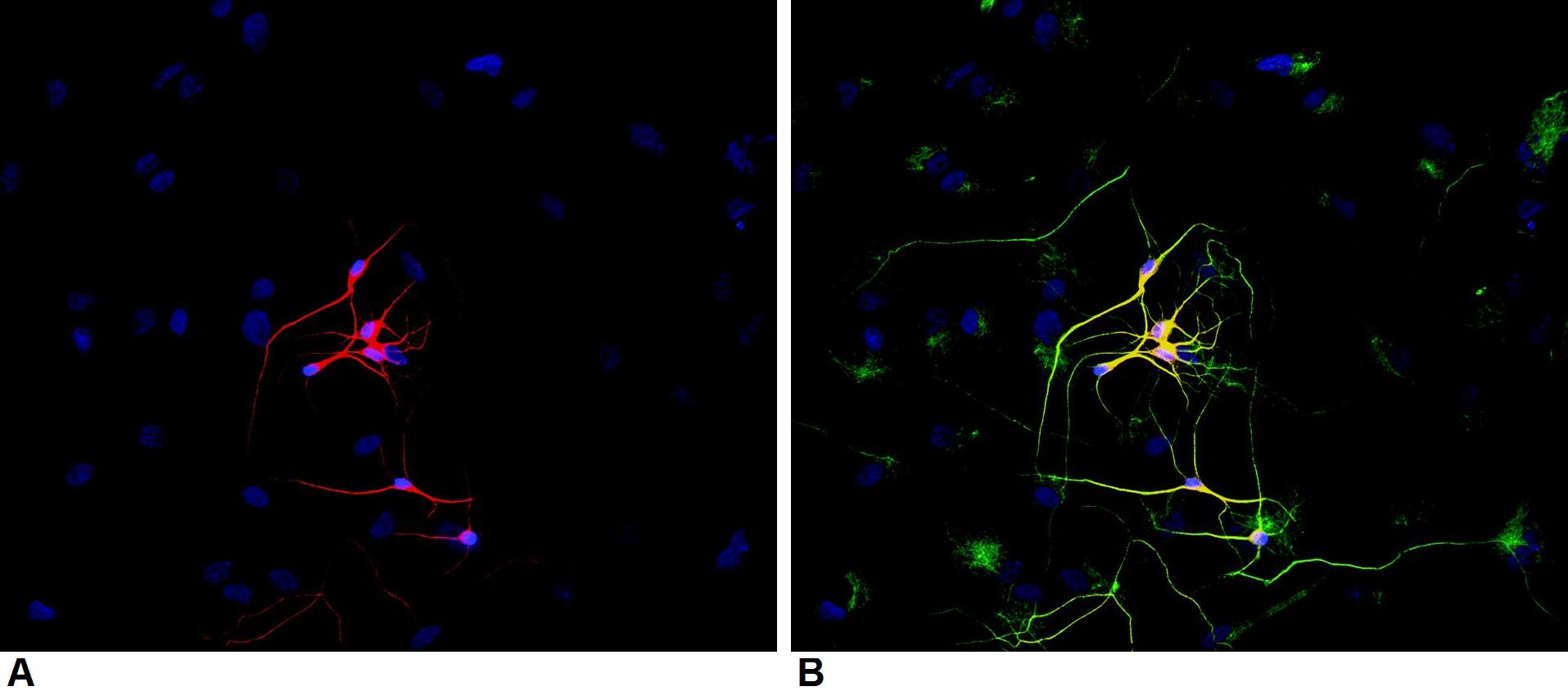 beta Tubulin 3/ Tuj1 antibody [TU-20]