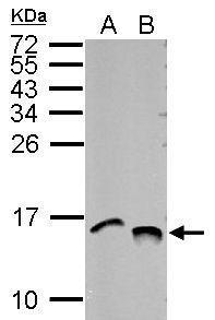 Histone H4K5K8K12K16ac (acetyl Lys5/Lys8/Lys12/Lys16) antibody