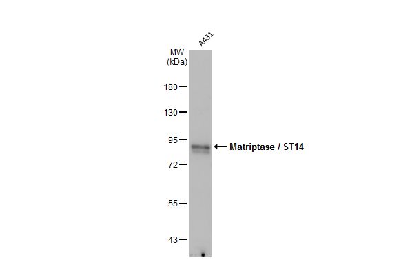Matriptase / ST14 antibody [M24]