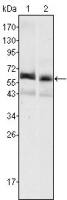 Alpha fetoprotein / AFP antibody [6E6]