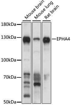 EphA4 antibody