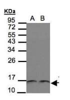 Thioredoxin antibody [N3C3]