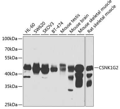 Casein Kinase 1 gamma 2 antibody