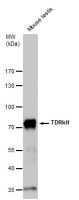 TDRKH antibody