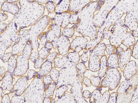 Insulin Receptor antibody [07]