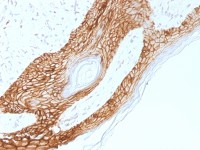 E-Cadherin antibody [4A2]