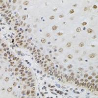 Transglutaminase 2 antibody