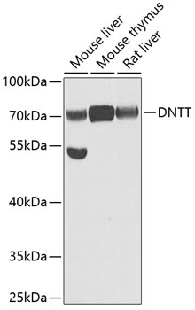 TdT antibody