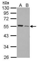 Desmin antibody