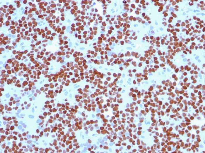 Nkx2.2 antibody [NX2/294]