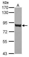 CD36 antibody