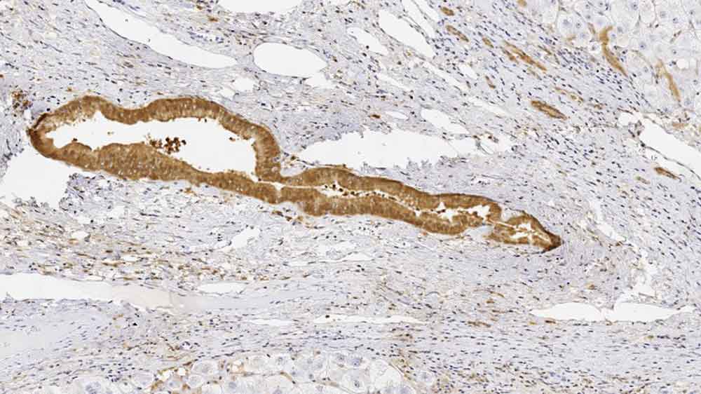 GSTP1 antibody [LW29]