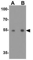 CRBN antibody