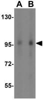 TNPO3 antibody