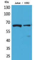 NFkB p65 (acetyl Lys218) antibody