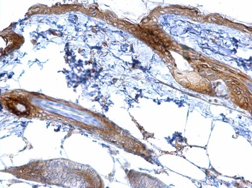 CXCR5 antibody [C1C2], Internal