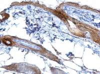 CXCR5 antibody [C1C2], Internal
