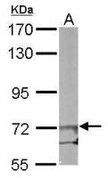 EIF2B epsilon antibody