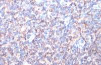 HLA-A antibody [N1C2]