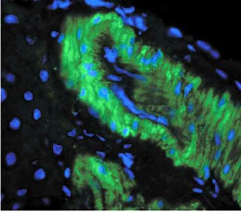 Nitrotyrosine antibody [39B6]
