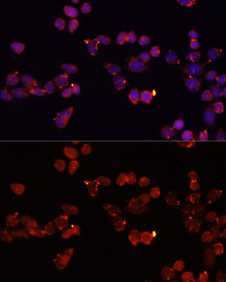 Adenine Nucleotide Translocase 1 antibody