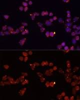 Adenine Nucleotide Translocase 1 antibody