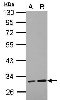 LRRC19 antibody