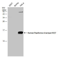 Human Papillomavirus type 18 E7 antibody