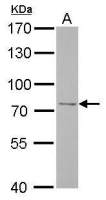 FBXO21 antibody