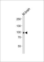 ADAMTS4 antibody, C-term